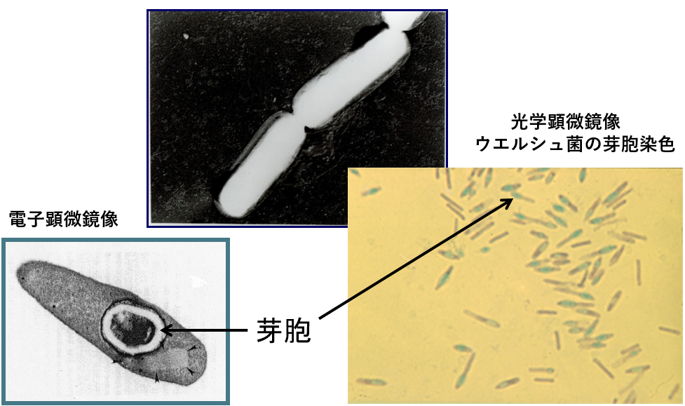 図1. 光学顕微鏡像と電子顕微鏡像での芽胞の位置